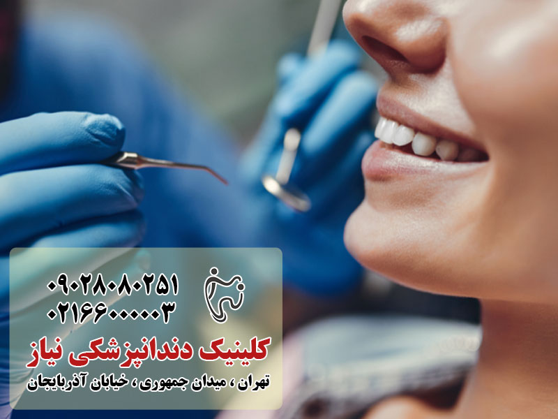 مراقبت و درمان دندان در تهران: راهنمای جامع برای داشتن لبخندی سالم و زیبا