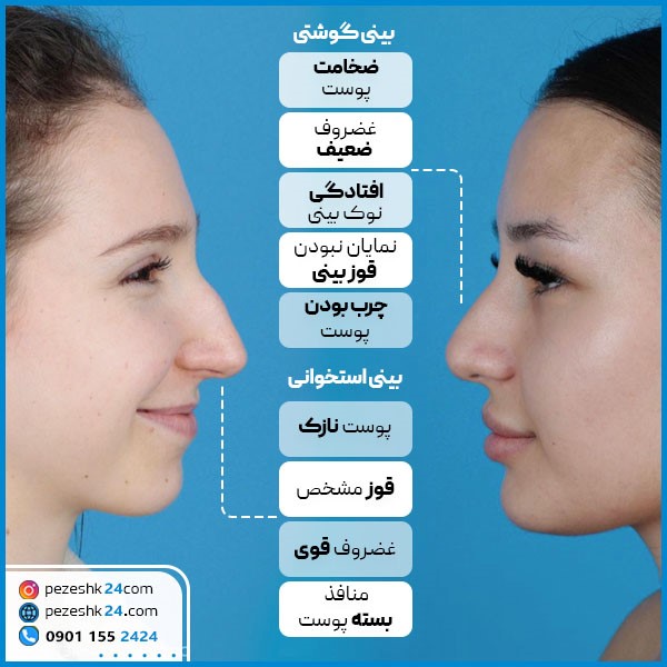 تشخیص بینی استخوانی از گوشتی
