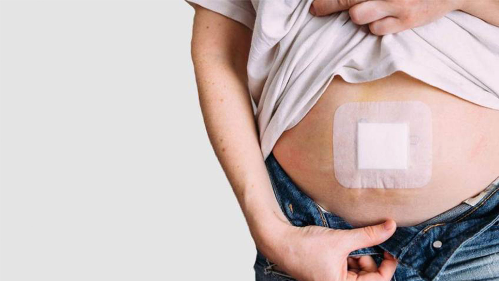 عدم رعایت مراقبت‌های پس از جراحی