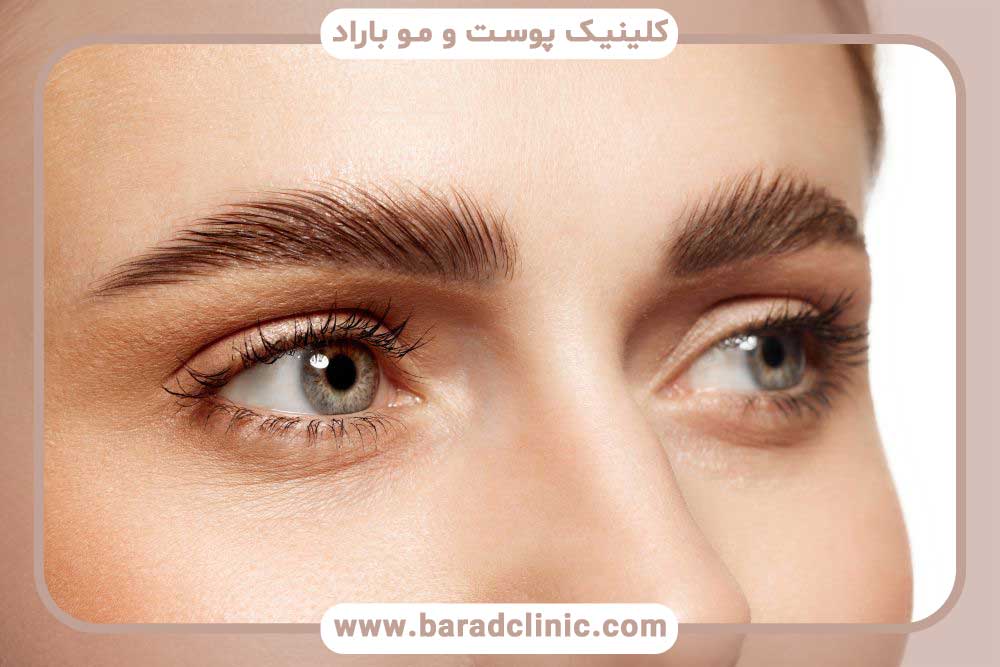 کاشت ابرو با موهای طبیعی چگونه انجام می‌شود؟