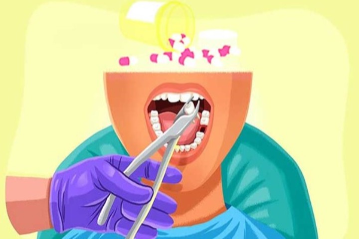 بعد از کشیدن دندان چه قرصی بخوریم که عفونت نکنه؟