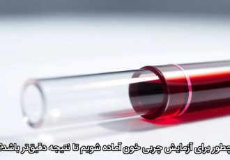 چطور برای آزمایش چربی خون آماده شویم تا نتیجه دقیق‌تر باشد؟