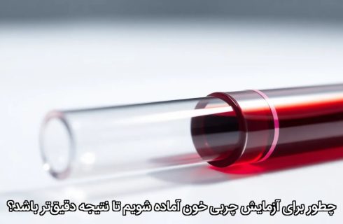 چطور برای آزمایش چربی خون آماده شویم تا نتیجه دقیق‌تر باشد؟