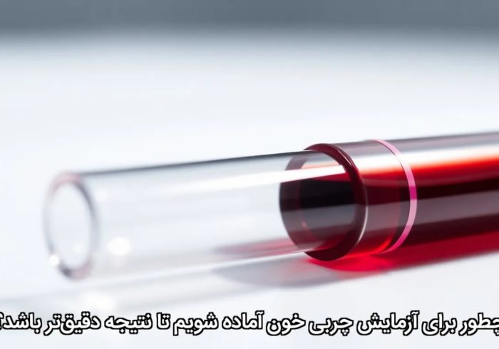 چطور برای آزمایش چربی خون آماده شویم تا نتیجه دقیق‌تر باشد؟