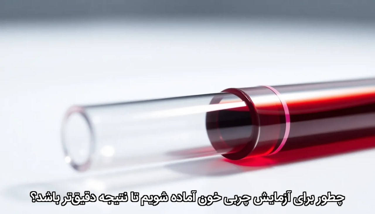 چطور برای آزمایش چربی خون آماده شویم تا نتیجه دقیق‌تر باشد؟