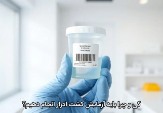 کی و چرا باید آزمایش کشت ادرار انجام دهیم؟