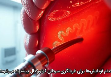 کدام آزمایش‌ها برای غربالگری سرطان کولورکتال پیشنهاد می‌شود؟