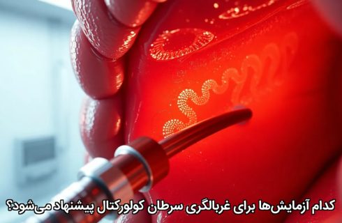 کدام آزمایش‌ها برای غربالگری سرطان کولورکتال پیشنهاد می‌شود؟