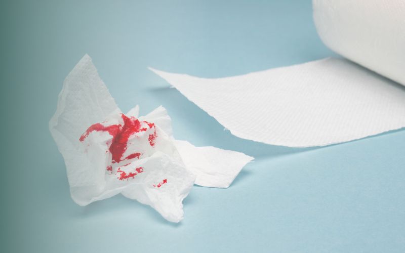 چرا نباید خونریزی مقعدی را نادیده گرفت؟ هشدار پزشکان چرا خونریزی مقعدی داریم؟