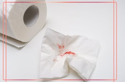 چرا نباید خونریزی مقعدی را نادیده گرفت؟ هشدار پزشکان
