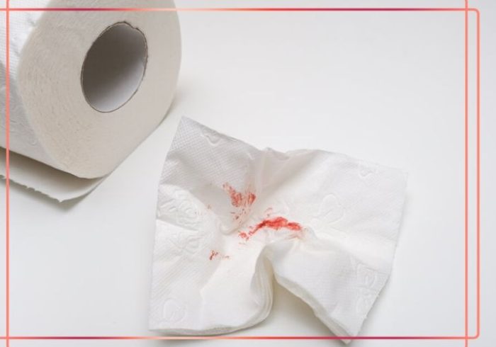 چرا نباید خونریزی مقعدی را نادیده گرفت؟ هشدار پزشکان