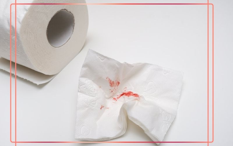 چرا نباید خونریزی مقعدی را نادیده گرفت؟ هشدار پزشکان