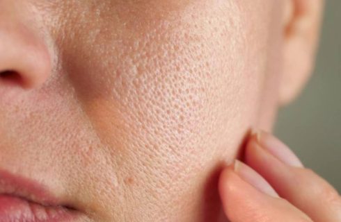 بهترین کرم برای منافذ باز پوست