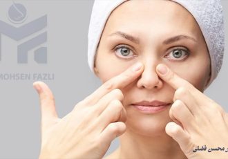 راز پنهان جراحی بینی؛ آنچه قبل از عمل باید بدانید راز پنهان جراحی بینی؛ آنچه قبل از عمل باید بدانید