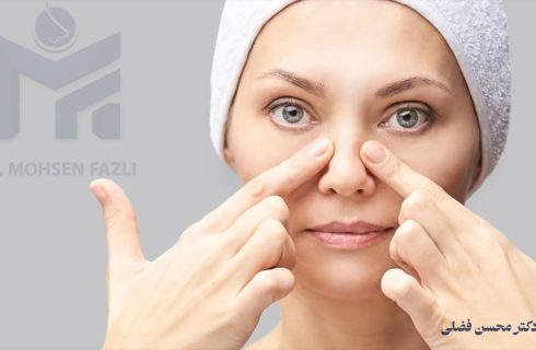 راز پنهان جراحی بینی؛ آنچه قبل از عمل باید بدانید راز پنهان جراحی بینی؛ آنچه قبل از عمل باید بدانید