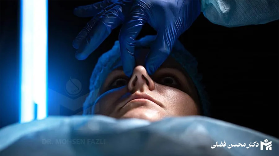 راز پنهان جراحی بینی؛ آنچه قبل از عمل باید بدانید راز پنهان جراحی بینی؛ آنچه قبل از عمل باید بدانید