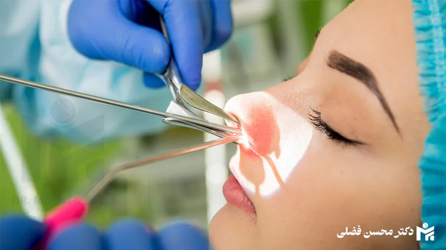 راز پنهان جراحی بینی؛ آنچه قبل از عمل باید بدانید راز پنهان جراحی بینی؛ آنچه قبل از عمل باید بدانید