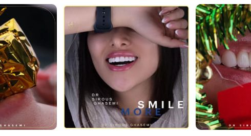 حساسیت دندان بعد از لمینت دندان: چگونه میتوان این عارضه را به صفر رساند؟ حساسیت دندان بعد از لمینت دندان: چگونه میتوان این عارضه را به صفر رساند؟