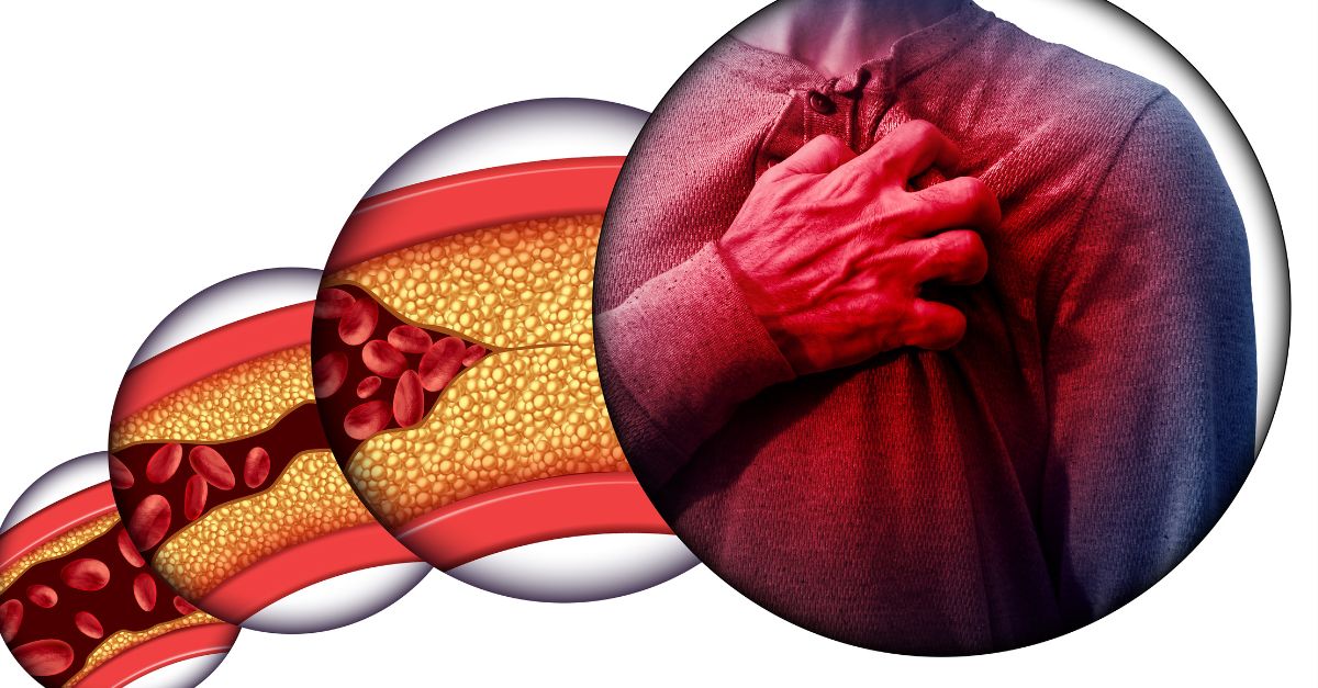 درمان بیماری های چاقی