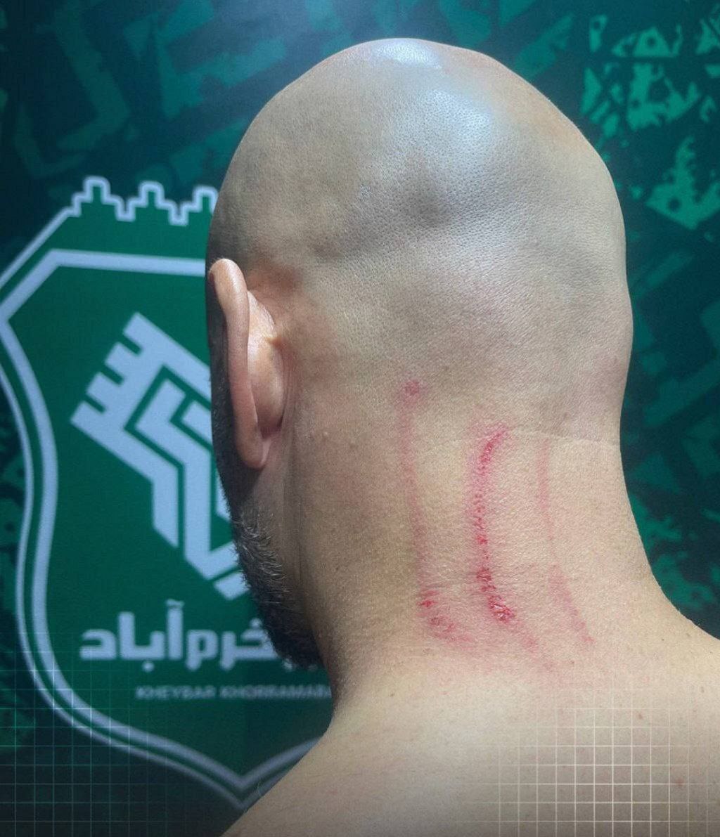 ادعای باشگاه استقلال: ضرب و شتم مربی آبیها پس از پایان بازی ادعای باشگاه استقلال: ضرب و شتم مربی آبیها پس از پایان بازی