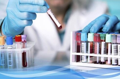 اعتماد اتحادیه اروپا به آزمایشگاه‌های مرجع ایران