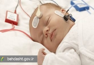 افزایش کیفیت غربالگری شنوایی در همدان افزایش کیفیت غربالگری شنوایی در همدان