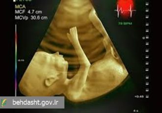 اقدامات اثر بخش دانشگاه علوم پزشکی مشهد در مسیر تشخیص زودهنگام و مداخلات پیش از تولد