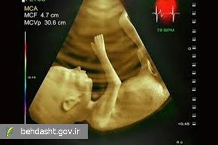 اقدامات اثر بخش دانشگاه علوم پزشکی مشهد در مسیر تشخیص زودهنگام و مداخلات پیش از تولد