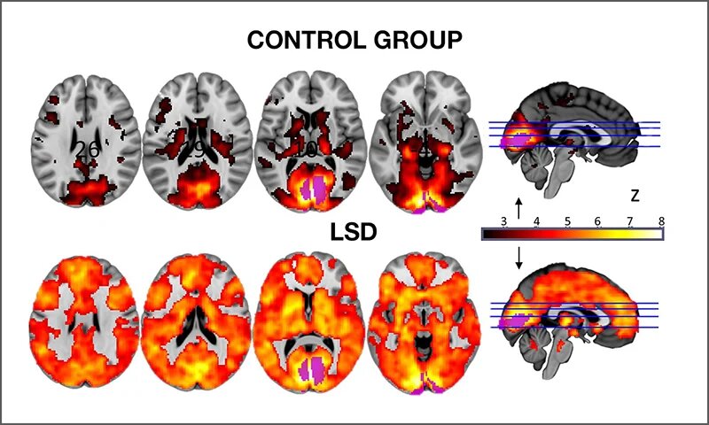 با این تکنیک ها مغزتان را از گذشته رها کنید و آیندهای تازه بسازید چطور مغزمان را از گذشته رها کنیم و آیندهای تازه بسازیم؟