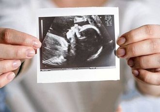 حمایت روانی، مهم‌ترین عامل تداوم بارداری است