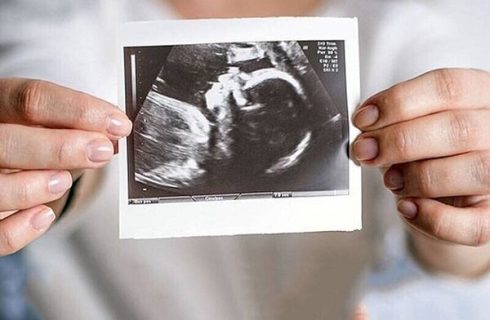 حمایت روانی، مهم‌ترین عامل تداوم بارداری است