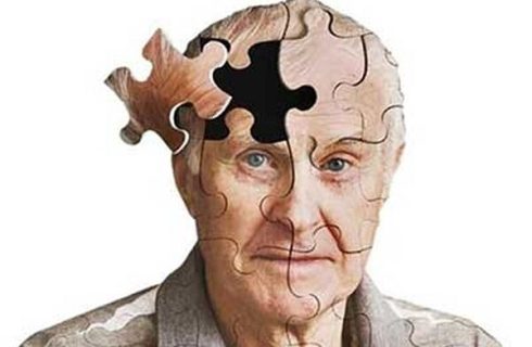 درمان سریع آسیب سر، خطر ابتلا به آلزایمر را کاهش می‌دهد