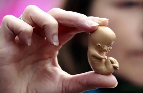 روزانه تا هزار سقط جنین در کشور؛ آماری ۳۰ برابر تلفات تصادفات! روزانه تا هزار سقط جنین در کشور؛ آماری ۳۰ برابر تلفات تصادفات!