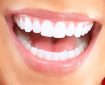 زیبایی لبخند بدون آسیب به دندان زیبایی لبخند بدون آسیب به دندان