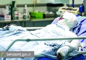 سوختگی در ایران هشت برابر میانگین جهانی است