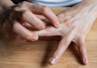 علل خارش انگشتان دست و راههای تشخیص و درمان آن علل خارش انگشتان دست و راههای تشخیص و درمان آن