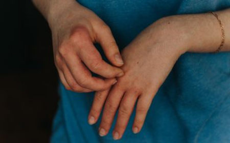 خارش انگشتان دست, درمان خارش انگشتان دست