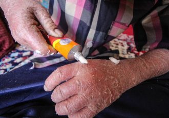 لزوم شفافیت بودجه‌ای انجمن‌های حمایت از بیماران