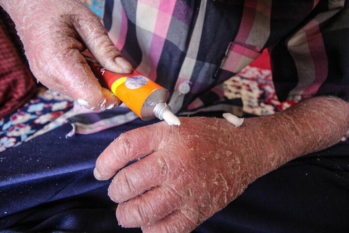 لزوم شفافیت بودجه‌ای انجمن‌های حمایت از بیماران