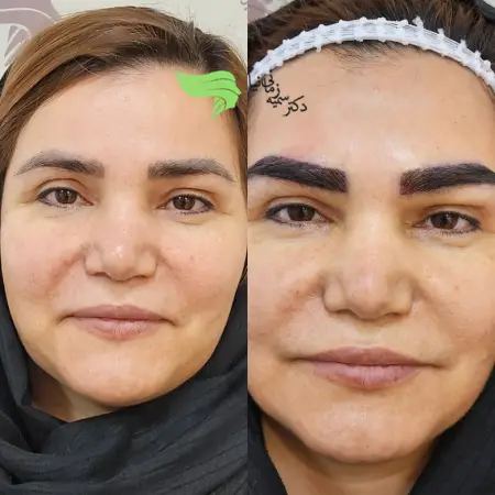 مهترین مدل های کاشت ابرو