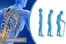 پوکی استخوان بیماری خاموش اما قابل پیشگیری و درمان است پوکی استخوان بیماری خاموش اما قابل پیشگیری و درمان است