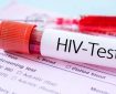 چه کسانی باید آزمایش «ایدز» بدهند