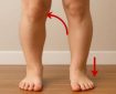 کف پای صاف چگونه باعث انحراف زانو می‌شود؟