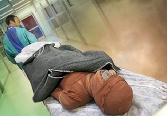 کمبود هزار تخت بیمارستانی سوختگی در کشور