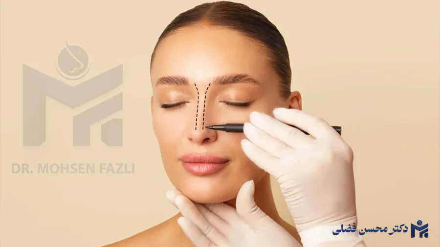 تکنیک طلایی بعد از جراحی بینی؛ ماساژی که چهره را متحول خواهد کرد