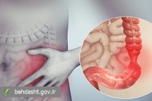 التهاب روده، خطر پوکی استخوان را افزایش می‌دهد/حذف خودسرانه لبنیات سلامت بیماران گوارشی را تهدید می‌کند