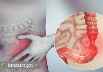 التهاب روده، خطر پوکی استخوان را افزایش می‌دهد/حذف خودسرانه لبنیات سلامت بیماران گوارشی را تهدید می‌کند