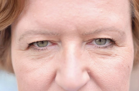 تغییرات در موقعیت پلک‌ها, علت پرش پلک چشم