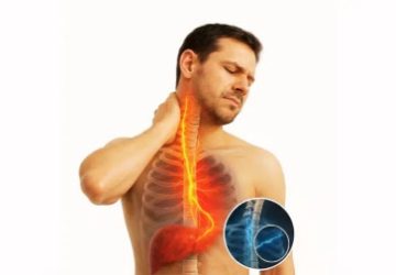 کبد چرب و درد گردن: ارتباطی که زندگی هزاران نفر را تغییر داد