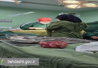 خارج‌سازی موفق توده رحمی ۱۵ سانتی‌متری در بیمارستان امام رضا(ع) کبودراهنگ